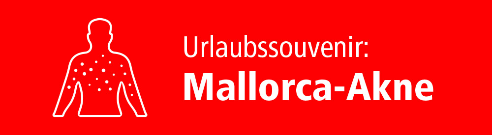 Urlaubssouvenir Mallorca-Akne